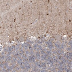 PHYHIPL Antibody, Novus Biologicals 0.1mL; Unlabeled:Antibodies, Polyclonal